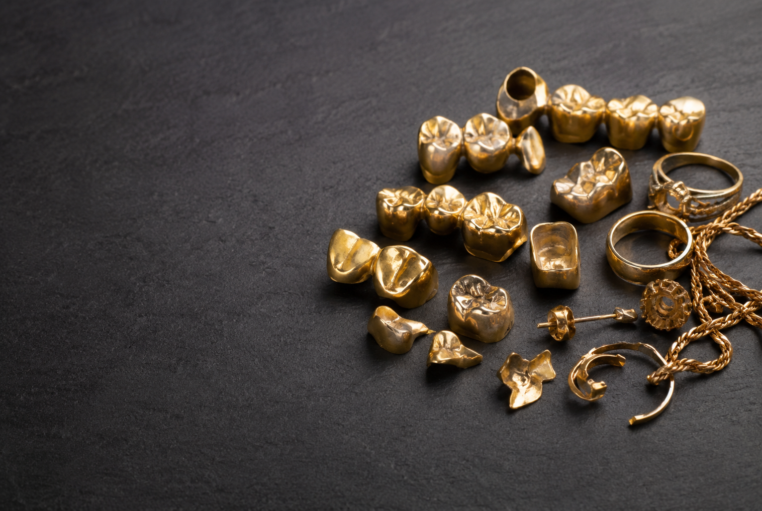 Dental gold crowns, bridges and scrap gold on stone at the InstaGold 47th Street office